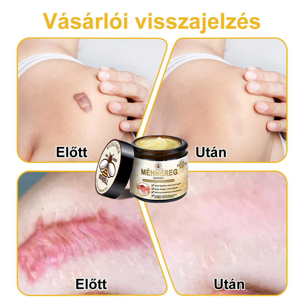 🐝💖BSWELL® Méhméreg Kezelés Krém👨‍⚕️（AAD ajánlott） (🔥utolsó nap promóció 80% ki