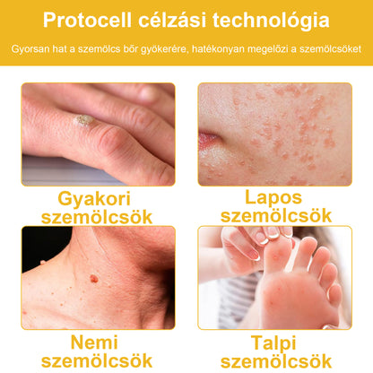 🐝💖BSWELL® Méhméreg Kezelés Krém👨‍⚕️（AAD ajánlott） (🔥utolsó nap promóció 80% ki